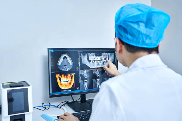 Best Emergency Tooth Extraction in Marshfield, MO
