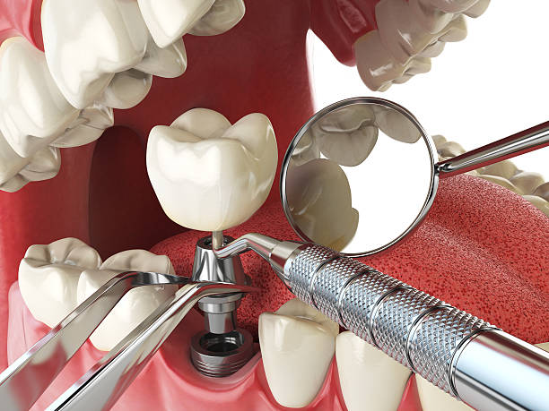 Emergency Dental Care for Seniors